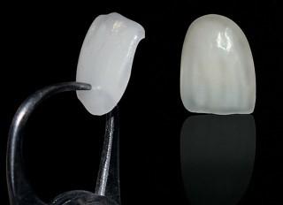 Ultrathin Veneer - Đẳng cấp răng sứ siêu mỏng hiện đại nhất Việt Nam!
