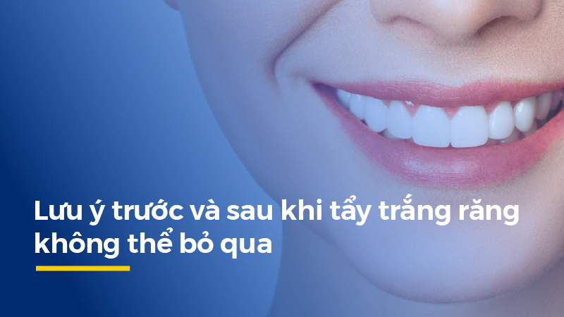 luu y tay trang rang tai nha