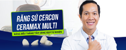 Banner bọc mão sứ Viva Clinic bản mobile