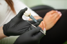 implant viva 263