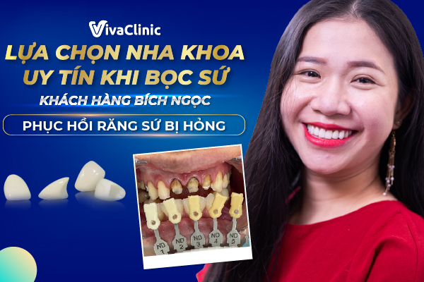 Bọc sứ kém uy tín