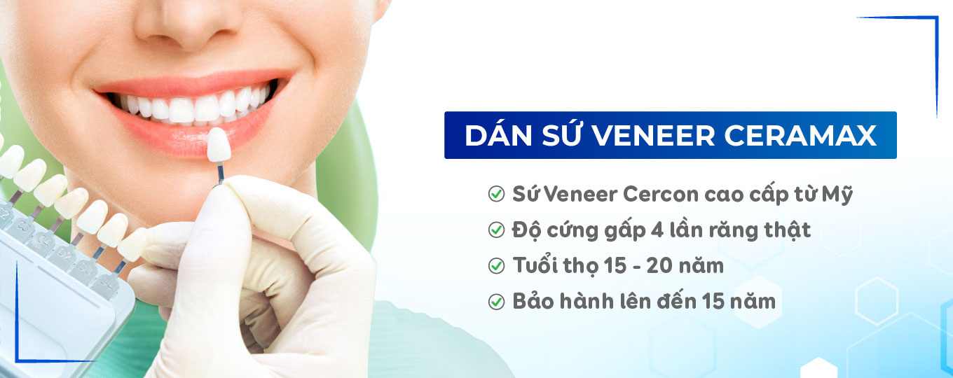 Dán sứ Veneer Ceramax | Nha khoa viva clinic