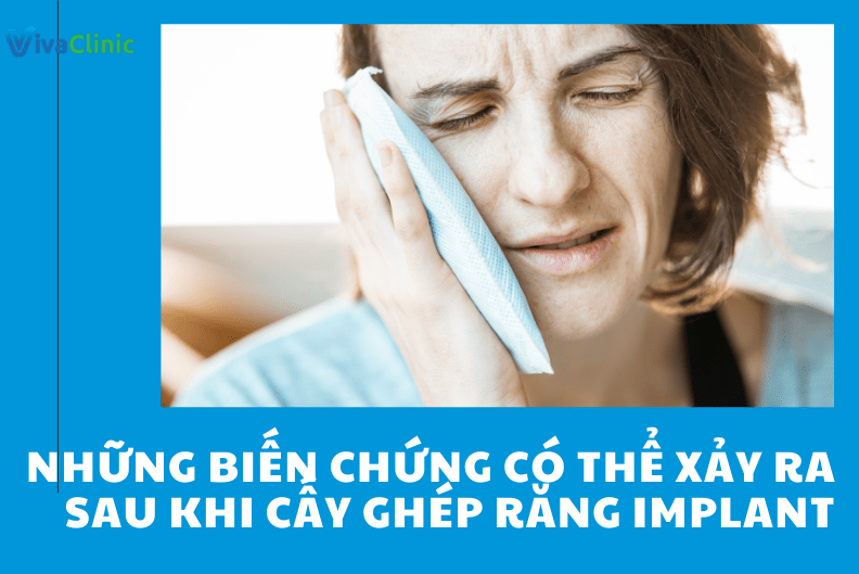 Những biến chứng có thể xảy ra sau khi cấy ghép răng Implant? Trồng implant kiêng gì?