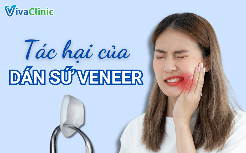 Tác hại của dán sứ veneer
