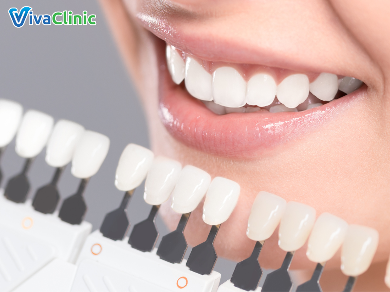 Quy trình bọc răng sứ chuẩn y khoa gồm mấy bước