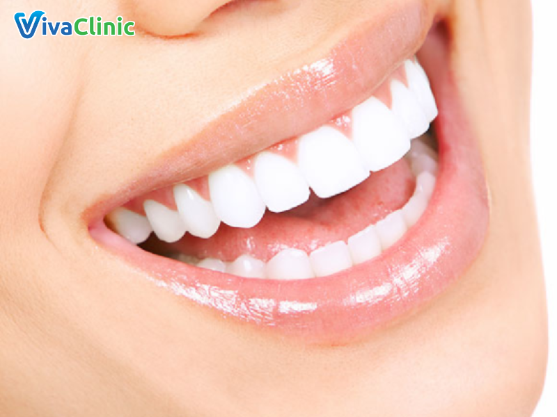 Những trường hợp nào thì nên bọc răng sứ răng hàm