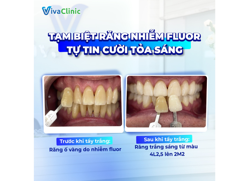 khach-hang-review-tay-trang-rang