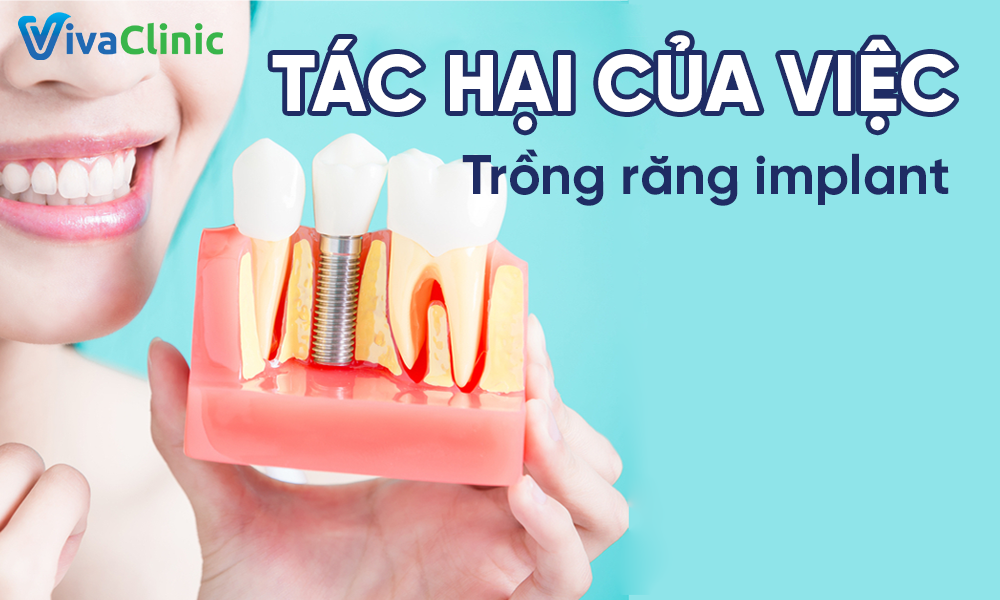 Những tác hại của việc trồng răng implant mà bạn không nên bỏ qua