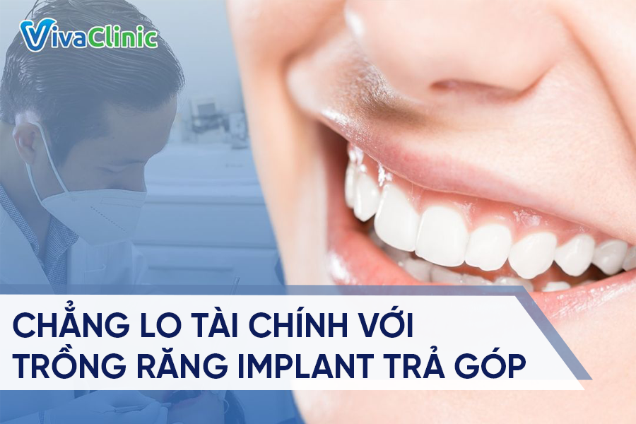 Chẳng lo tài chính với trồng răng implant trả góp tại Viva Clinic