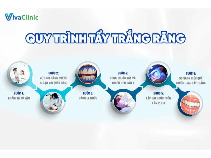 quy-trinh-tay-trang-rang