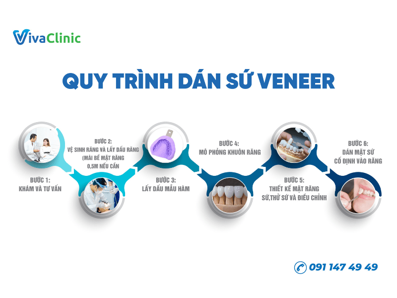 quy-trinh-dan-su-tai-nha-khoa-via