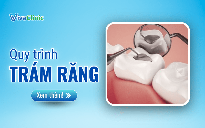 QUY TRINH TRAM RANG TAI VIVA CLINIC 1