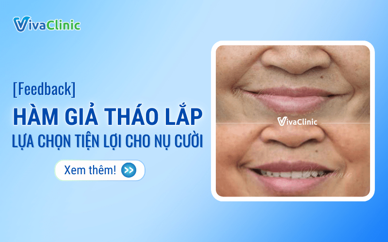 Feedback HAM GIA THAO LAP LUA CHON TIEN LOI CHO NU CUOI 2
