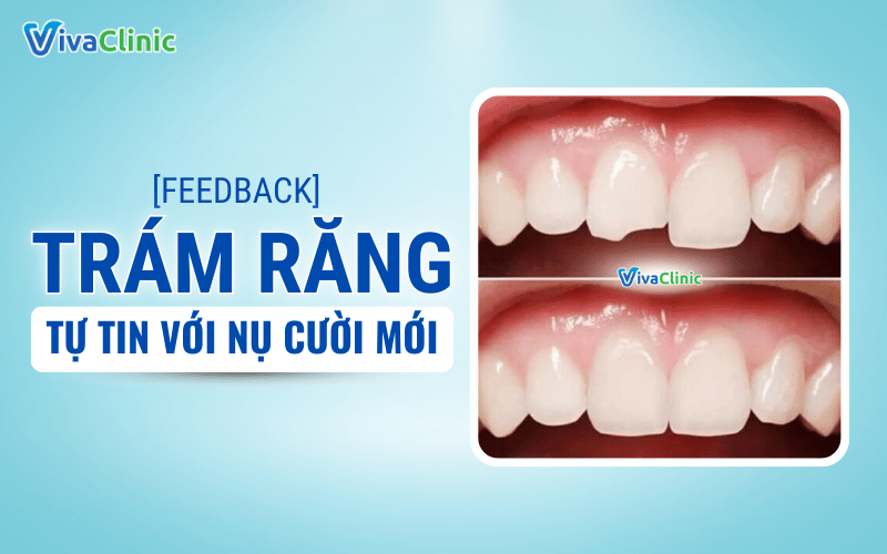 Feedback TRAM RANG TAM BIET NOI LO VOI NU CUOI MOI TU TIN HON 1 2