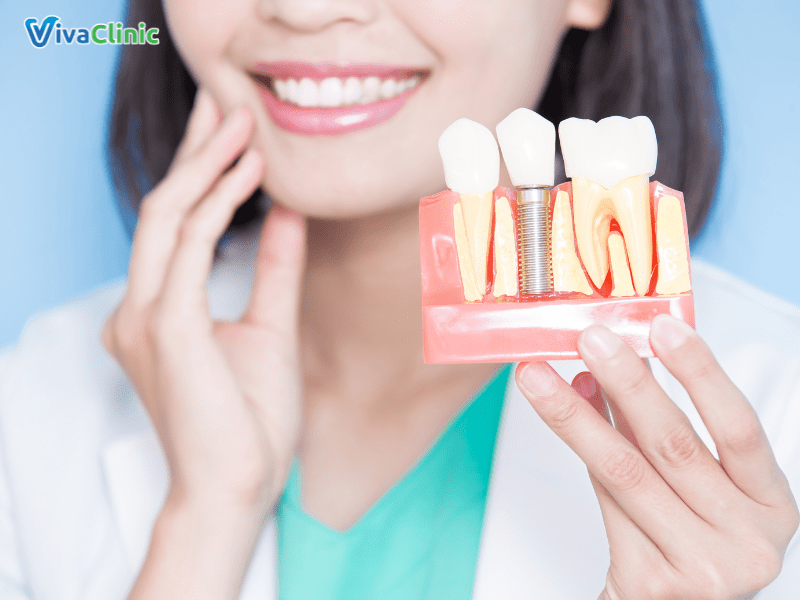 trong-rang-implant-tai-nha-khoa-viva-clinic