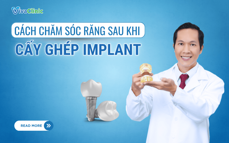 CACH CHAM SOC RANG SAU KHI CAY GHEP IMPLANT 1