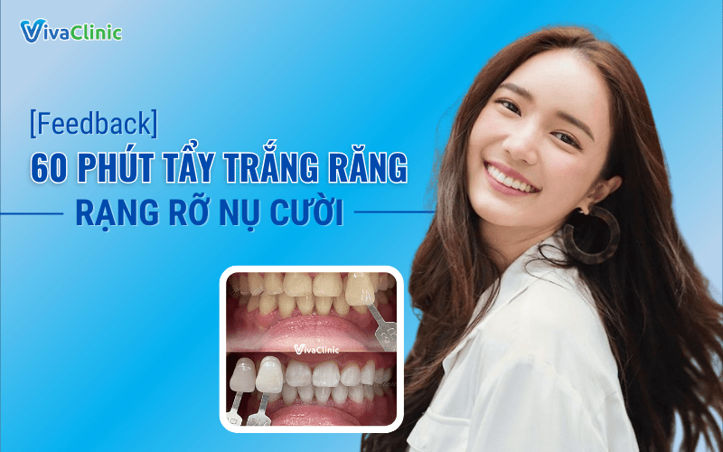 FEEDBACK 60 PHUT TAY TRANG RANG – RANG RO NU CUOI
