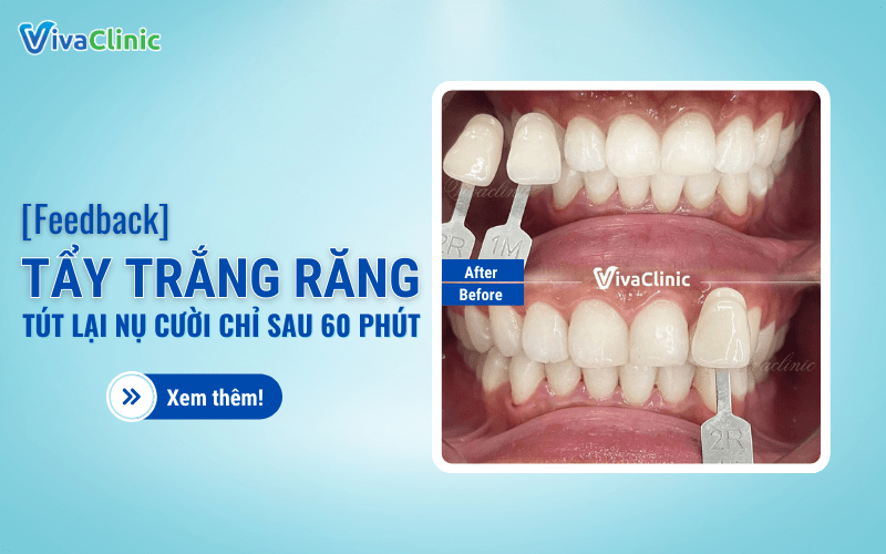 FEEDBACK TAY TRANG RANG TUT LAI NU CUOI CHI SAU 60 PHUT