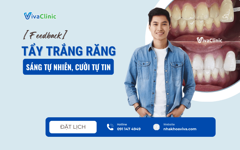 Feedback TAY TRANG RANG – SANG TU NHIEN CUOI TU TIN