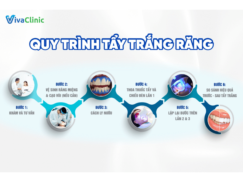 quy-trinh-tay-trang-rang