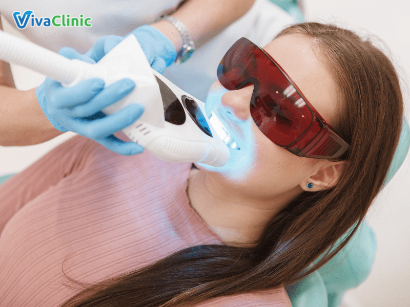 tay-trang-rang-tai-viva-clinic