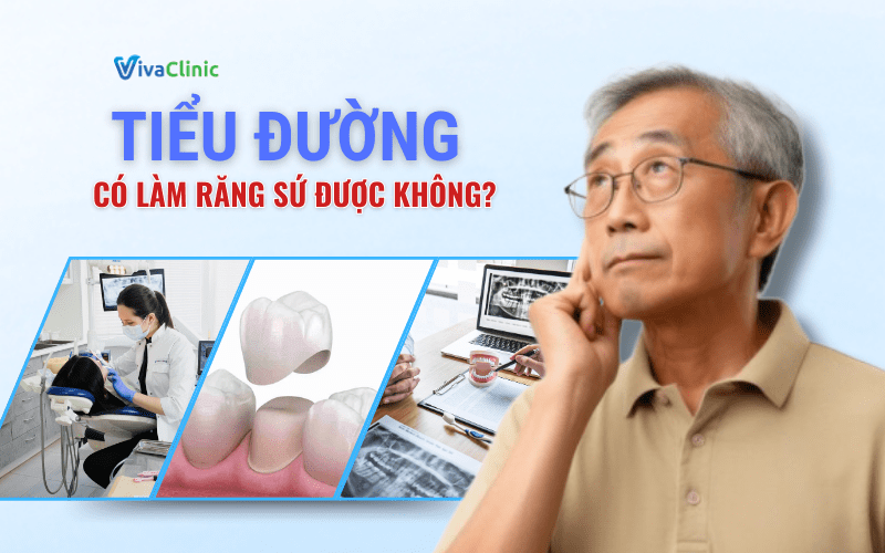 TIEU DUONG CO LAM RANG SU DUOC KHONG