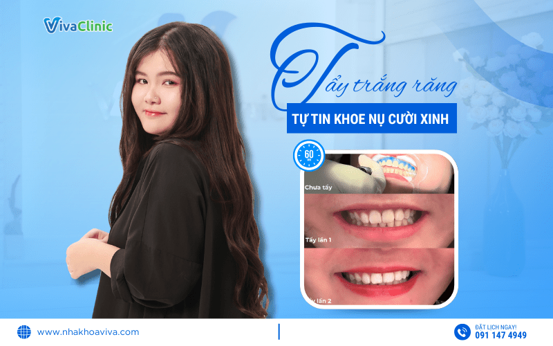 Feedback TAY TRANG RANG TU TIN KHOE NU CUOI XINH